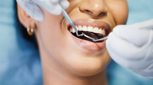 Best Emergency Dental Care for Broken or Chipped Teeth in Mount Pleasant, TN