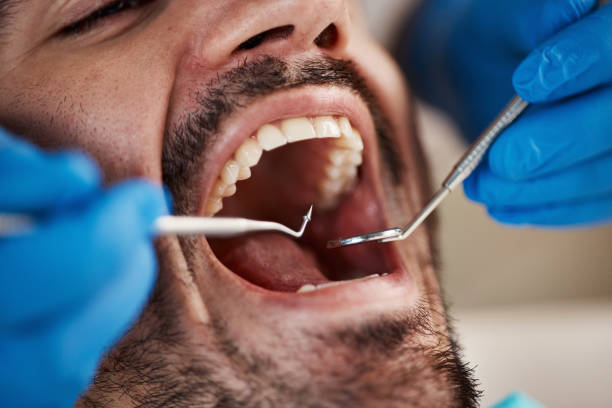 Best Same-Day Emergency Dental Services in Mount Pleasant, TN