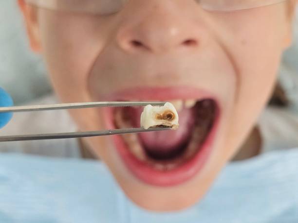 Best 24-Hour Emergency Dentist in Mount Pleasant, TN